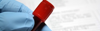 Closeup photo of a latex gloved hand holding a vial of blood