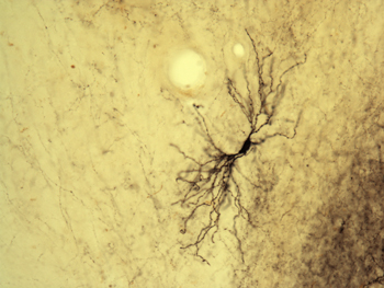 Photo of histological staining of neuron complex