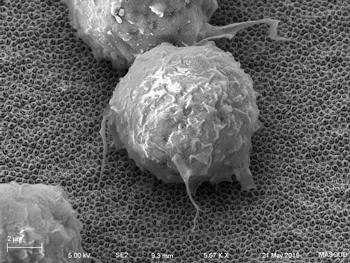 Scanning electron micrograph of macrophage