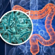 Role of gut microbiome in mediating increased incidence and severity of osteoarthritis in obese patients