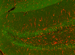Astrocytes in HZE irradiated hippocampus