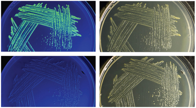 strains on petri dishes