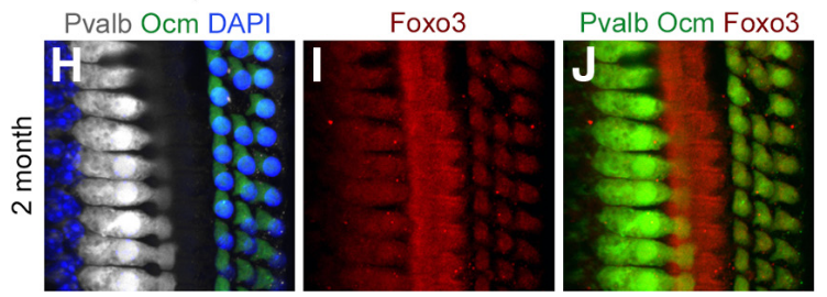Foxo3 expressed in cochlea