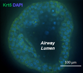 Immunofluorescent image of airway grown from a single Keratin 5+ cell