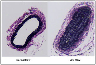 morrow-fig1