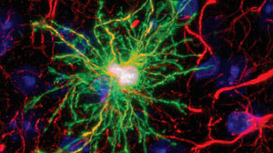 Human glial cell within mouse glial cells