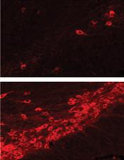microscopic image of dopamine