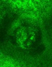 image of a Meissner corpuscle