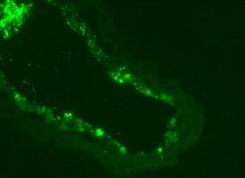 image of micro RNS molecule