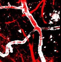 image of amyloid deposit in the mouse brain