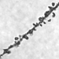 Electron Microscope Phohto of Dendritic Spines