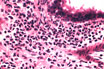 Leukocyte Homing & Migration