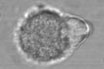 Antigen Presentation