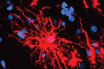 Neurogenetics