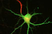 Stem Cells, Neuroregeneration, & Repair