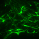 Picture of Fibronectin Matrix Remodeling in Chronic Diseases
