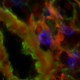Determinants of Heterosubtypic Immunity to Influenza