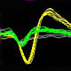 Biomimetic microstimulation to repair focal nervous system injury