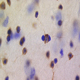 Neural Substrates of Plasticity in the Amygdala