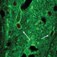 Effects of Stress on Amygdala Development and Behavior in Adolescent Rats