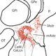 Characterizing Amygdala Networks in Anxious Adolescents