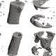 Bone Repair and Regeneration