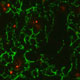 Role of Apoptotic Cell Find-Me Signals in the Clearance of Apoptotic Cells