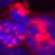 Staufen1(STAU1)-mediated mRNA decay (SMD)