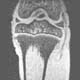 Characterizing Growth of the Knee Joint