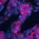 Cell-based Regeneration of Salivary Glands