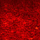 Real-time Visualization of the Effects of Cyclic and Static Loading on Healthy and Pathological Cartilage Mechanical and Structural Properties