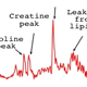 Picture of Model based MR spectroscopic imaging