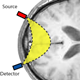 Picture of Reconstruction of functional activations from NIRSI data