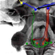 Picture of Auditory Processing of Complex Sounds