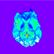 Picture of Pattern recognition in clinical real-world applications