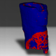 Tissue Engineering of Massive Bone Allograft Union