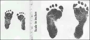 Footprints of the NICU's smallest success story