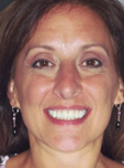 Grateful Eastman Dental Patient