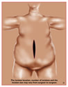 View incisions for open surgery