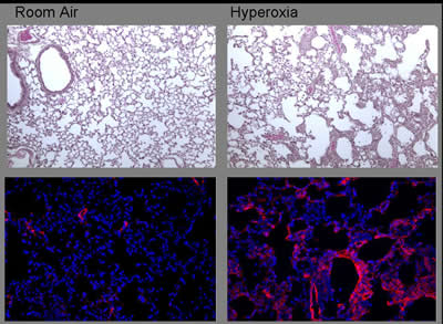 Effect of Neonatal Hyperoxia on Host Defense