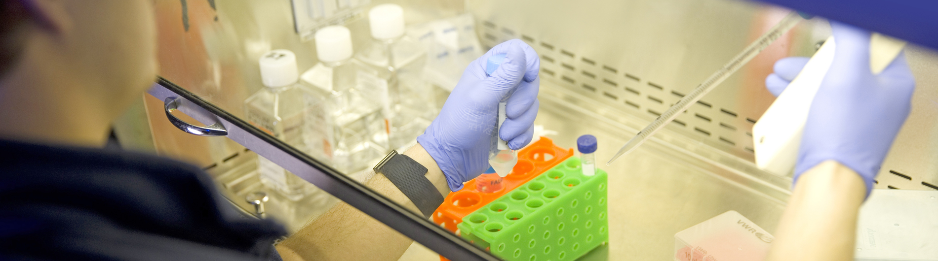 A person with blue gloves holds a pipette.
