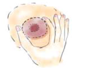 Hand placement on breast