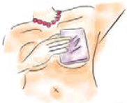 Warm your breast up with warm cloth