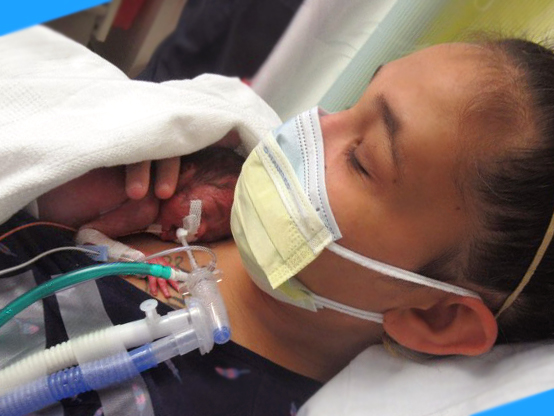 mom and intubated baby doing skin to skin