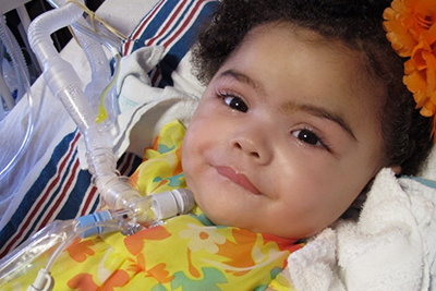 Baby girl with a Tracheostomy at Golisano Children's Hospital