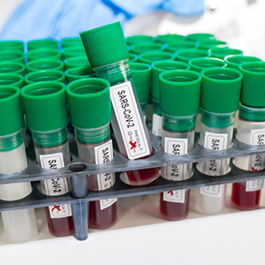 test tubes filled with blood samples marked SARS-CoV-2