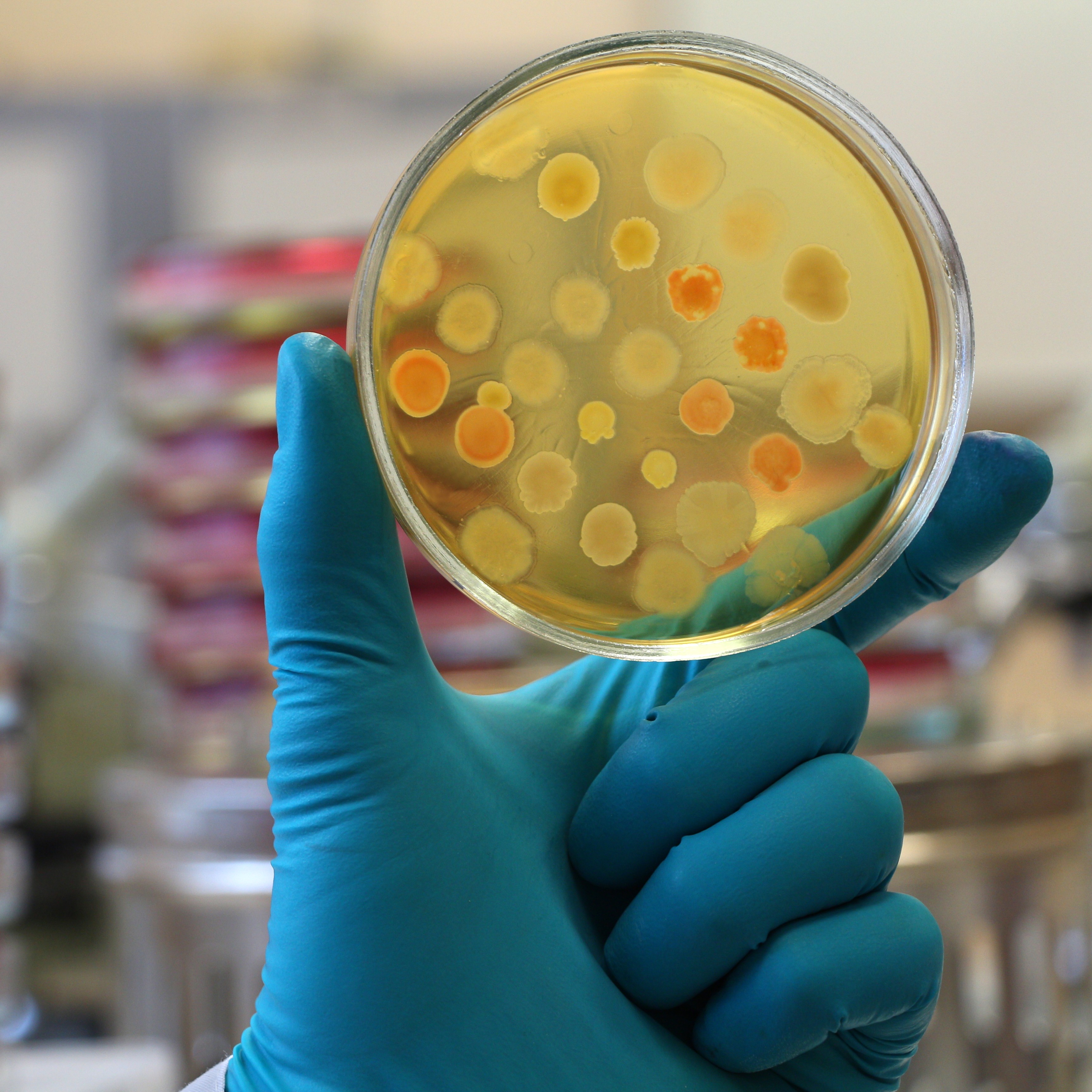 A petri dish with multiple spots of bacteria growing on it.