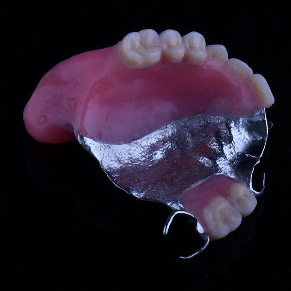 A device that resembles a cross between an orthodontic retainer and dentures. It covers the palate and has brackets to attach to the teeth. It also contains sections of false teeth and gums.