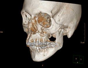 picture of skull head