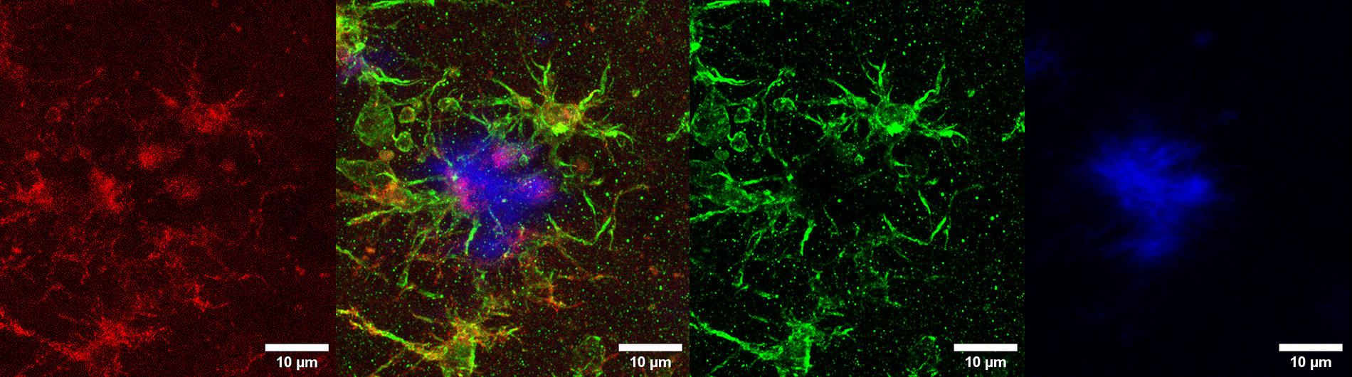 brain cell histology compilation of 4 images